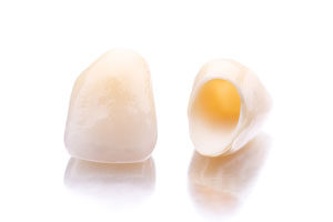 cerec-crowns-photo