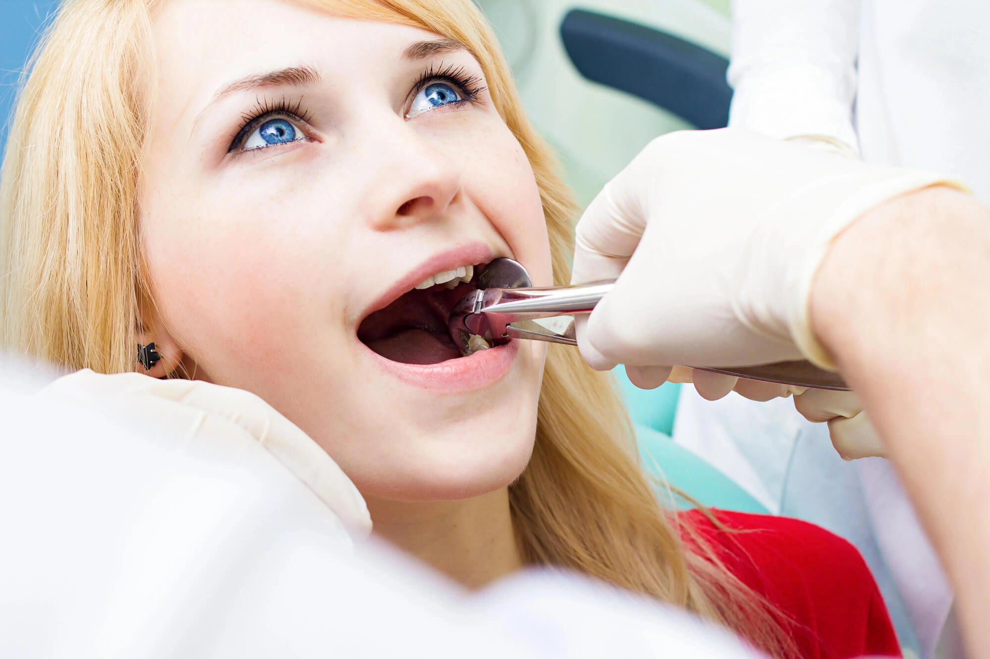 Tooth extraction Mamaroneck NY